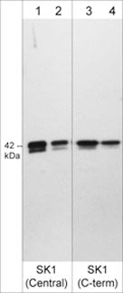 WB - Anti-Sphingosine Kinase 1 (C-terminal region) Antibody AN1969