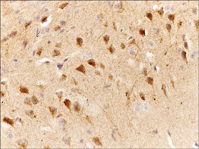 IHC - Anti-Slingshot-1L (C-terminal region) Antibody AN1957