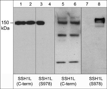 WB - Anti-Slingshot-1L (Ser-978), Phosphospecific Antibody AN1958