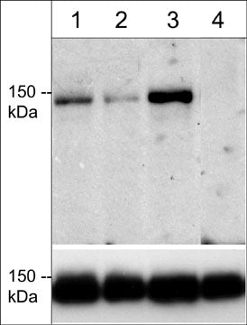 WB - Anti-mDia2 (Thr-1061), Phosphospecific Antibody AN1742