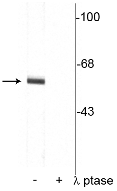  - Anti-Synaptotagmin (Thr202) Antibody AN1570