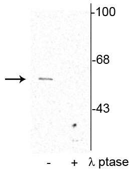  - Anti-Synaptotagmin (Ser309) Antibody AN1571