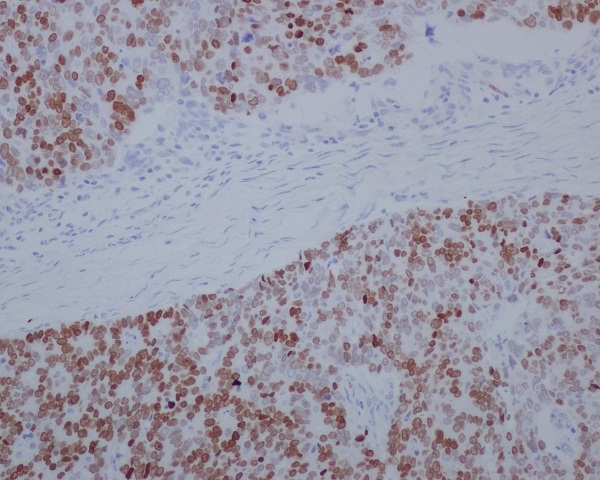 IHC - Anti-SATB2 Rabbit Monoclonal Antibody ABO13587
