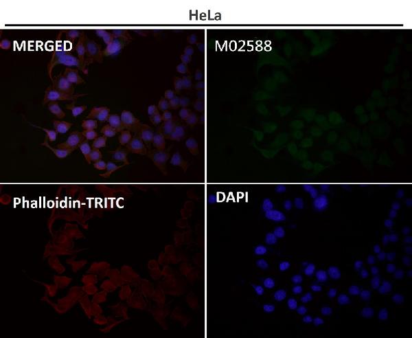 WB - Anti-SATB2 Rabbit Monoclonal Antibody ABO13587