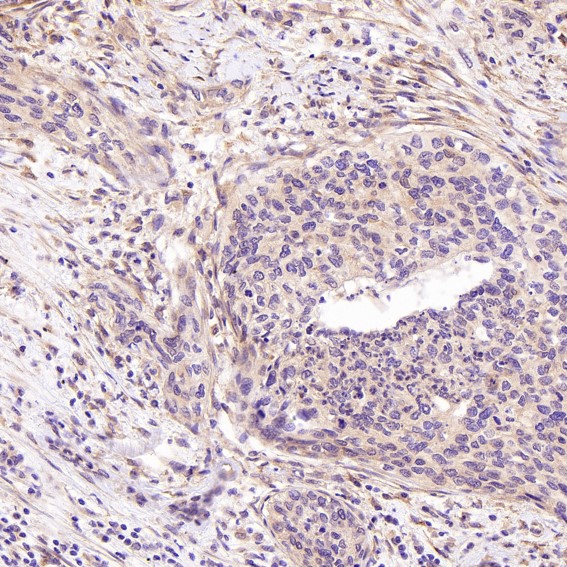 IHC - Anti-SATB2 Rabbit Monoclonal Antibody ABO13587