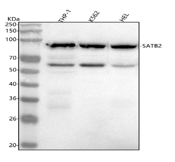 WB - Anti-SATB2 Rabbit Monoclonal Antibody ABO13587