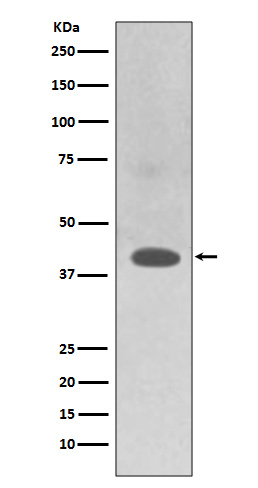 WB - Anti-TRAM2 Rabbit Monoclonal Antibody ABO13599