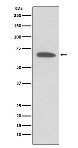 WB - Anti-KCNA1/Kv1.1 Rabbit Monoclonal Antibody ABO13668
