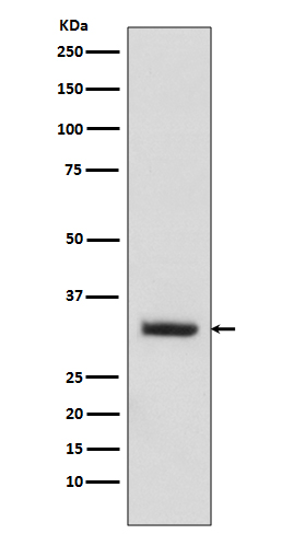 WB - Anti-C10orf63 ENKUR Rabbit Monoclonal Antibody ABO13911