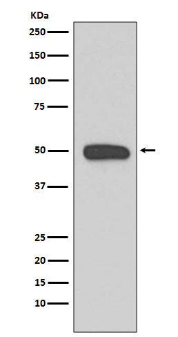 WB - Anti-Cytokeratin 13 Rabbit Monoclonal Antibody ABO14191