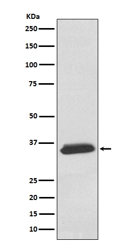 WB - Anti-delta Sarcoglycan SGCD Rabbit Monoclonal Antibody ABO14250