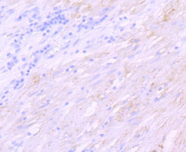 IHC - Anti-delta Sarcoglycan SGCD Rabbit Monoclonal Antibody ABO14250