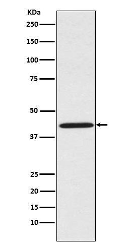 WB - Anti-Sprouty 2 SPRY2 Monoclonal Antibody ABO14694