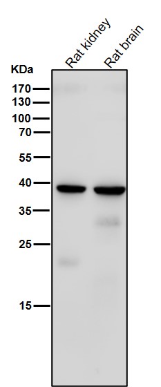 WB - Anti-Sprouty 2 SPRY2 Monoclonal Antibody ABO14694