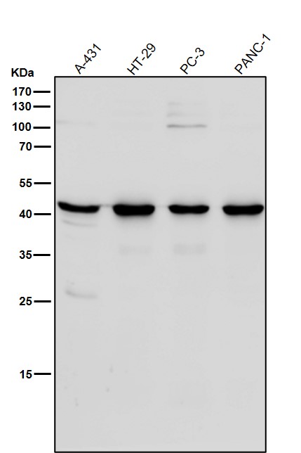 WB - Anti-Sprouty 2 SPRY2 Monoclonal Antibody ABO14694