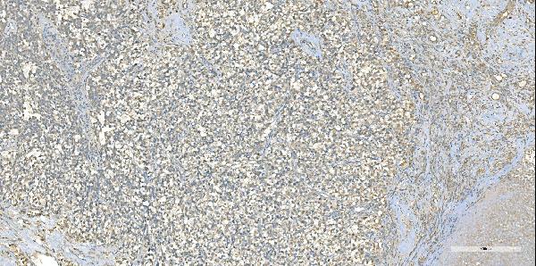 IHC - Anti-EPRS1/PARS Antibody Picoband™ (monoclonal, 12B5B3) ABO15114