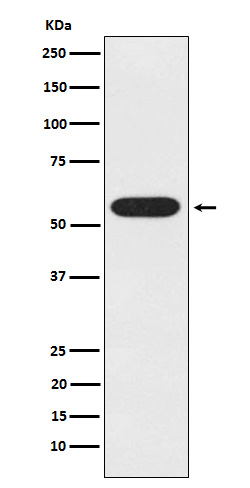 WB - Anti-UAP1 Rabbit Monoclonal Antibody ABO15249