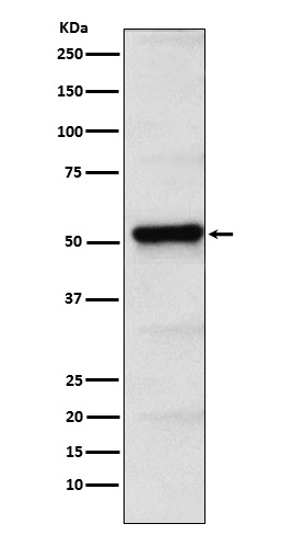 WB - Anti-PICK1 Rabbit Monoclonal Antibody ABO15390