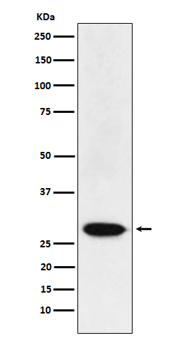 WB - Anti-MAD3 Rabbit Monoclonal Antibody ABO15605