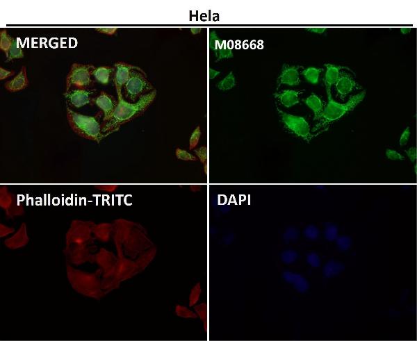 WB - Anti-TOMM22/TOM22 Rabbit Monoclonal Antibody ABO15659