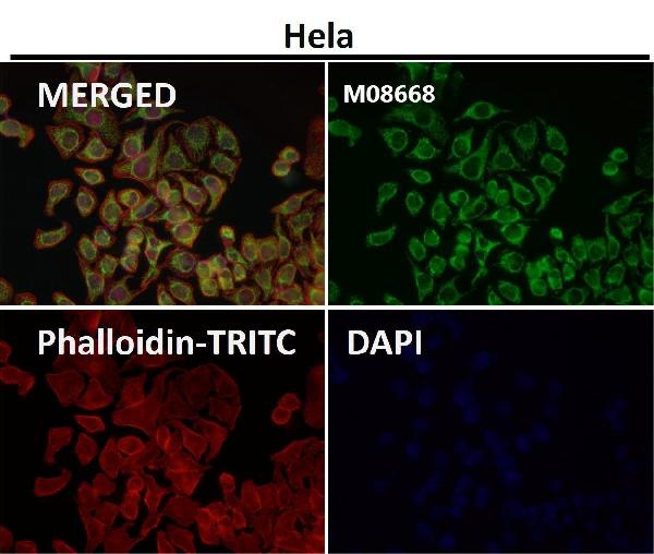 WB - Anti-TOMM22/TOM22 Rabbit Monoclonal Antibody ABO15659