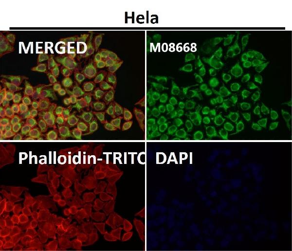 WB - Anti-TOMM22/TOM22 Rabbit Monoclonal Antibody ABO15659