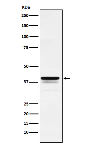 WB - Anti-FOXF1 Rabbit Monoclonal Antibody ABO15850