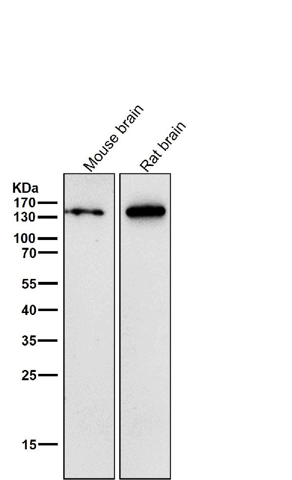 WB - Anti-CNTP2 Rabbit Monoclonal Antibody ABO16031