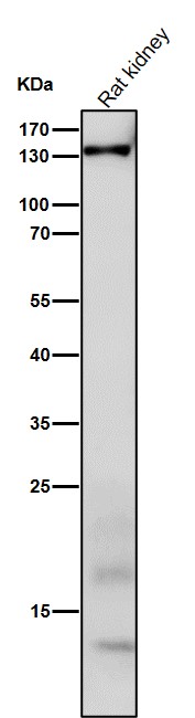 WB - Anti-CNTP2 Rabbit Monoclonal Antibody ABO16031