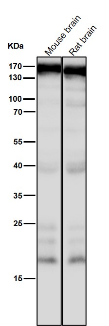 WB - Anti-CNTP2 Rabbit Monoclonal Antibody ABO16031