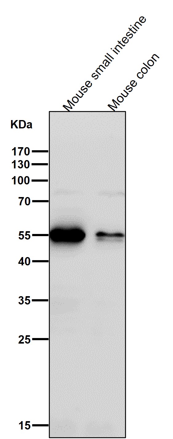 WB - Anti-ATP4B Rabbit Monoclonal Antibody ABO16032