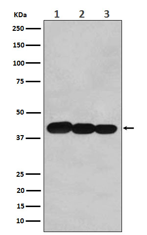 WB - Anti-BCLG Rabbit Monoclonal Antibody ABO16061