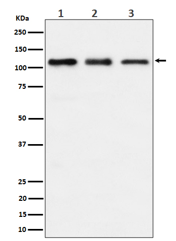 WB - Anti-TAOK1 Rabbit Monoclonal Antibody ABO16493