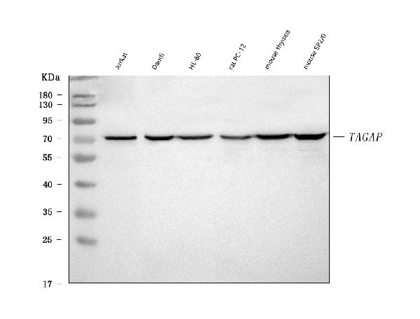  - Anti-TAGAP Rabbit Monoclonal Antibody ABO16504