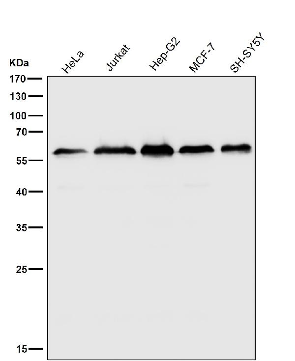 WB - Anti-KLC3 Rabbit Monoclonal Antibody ABO16812
