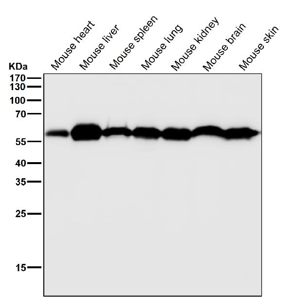 WB - Anti-KLC3 Rabbit Monoclonal Antibody ABO16812