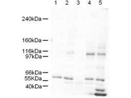  - Anti-SmarcAL1 (RABBIT) Antibody ASR5261