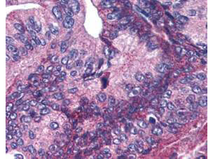  - Anti-APC1 pS377 (RABBIT) Antibody ASR5311