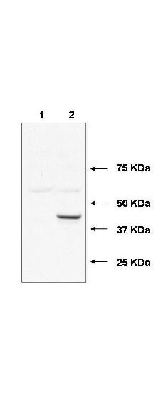 WB - Anti-Ubiquitin-Conjugating Enzyme E2 J1 (Ube2j1) (RABBIT) Antibody ASR5389