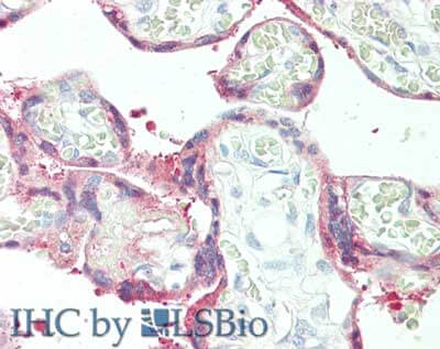  - Anti-Plasminogen Activator Inhibitor 2 (RABBIT) Antibody ASR5467