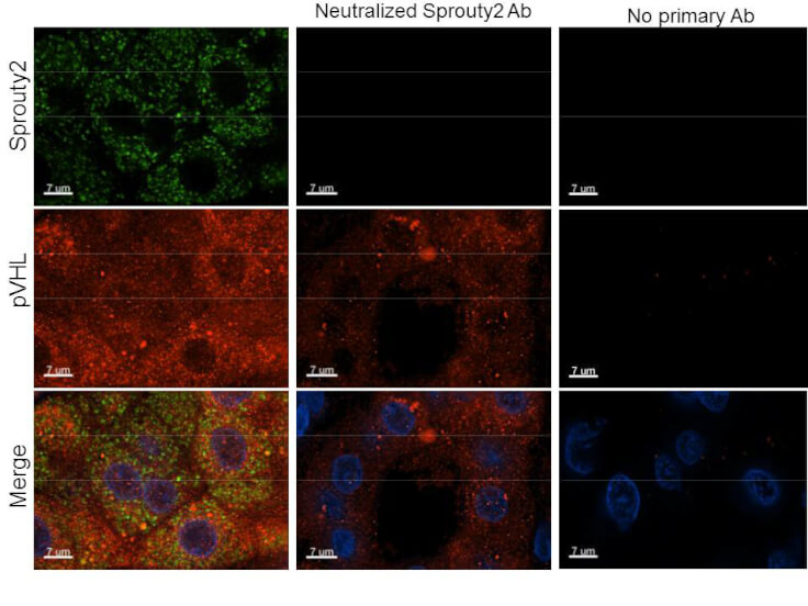 IF - Anti-Sprouty-2 (RABBIT) Antibody ASR5518
