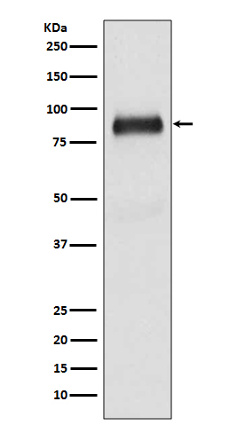 WB - SATB2 Antibody AP90164