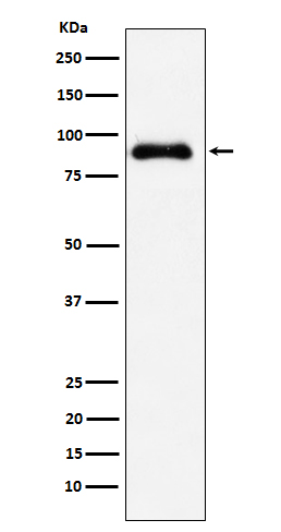 WB - SATB2 Antibody AP92062