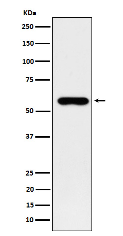WB - SUOX Antibody AP92696