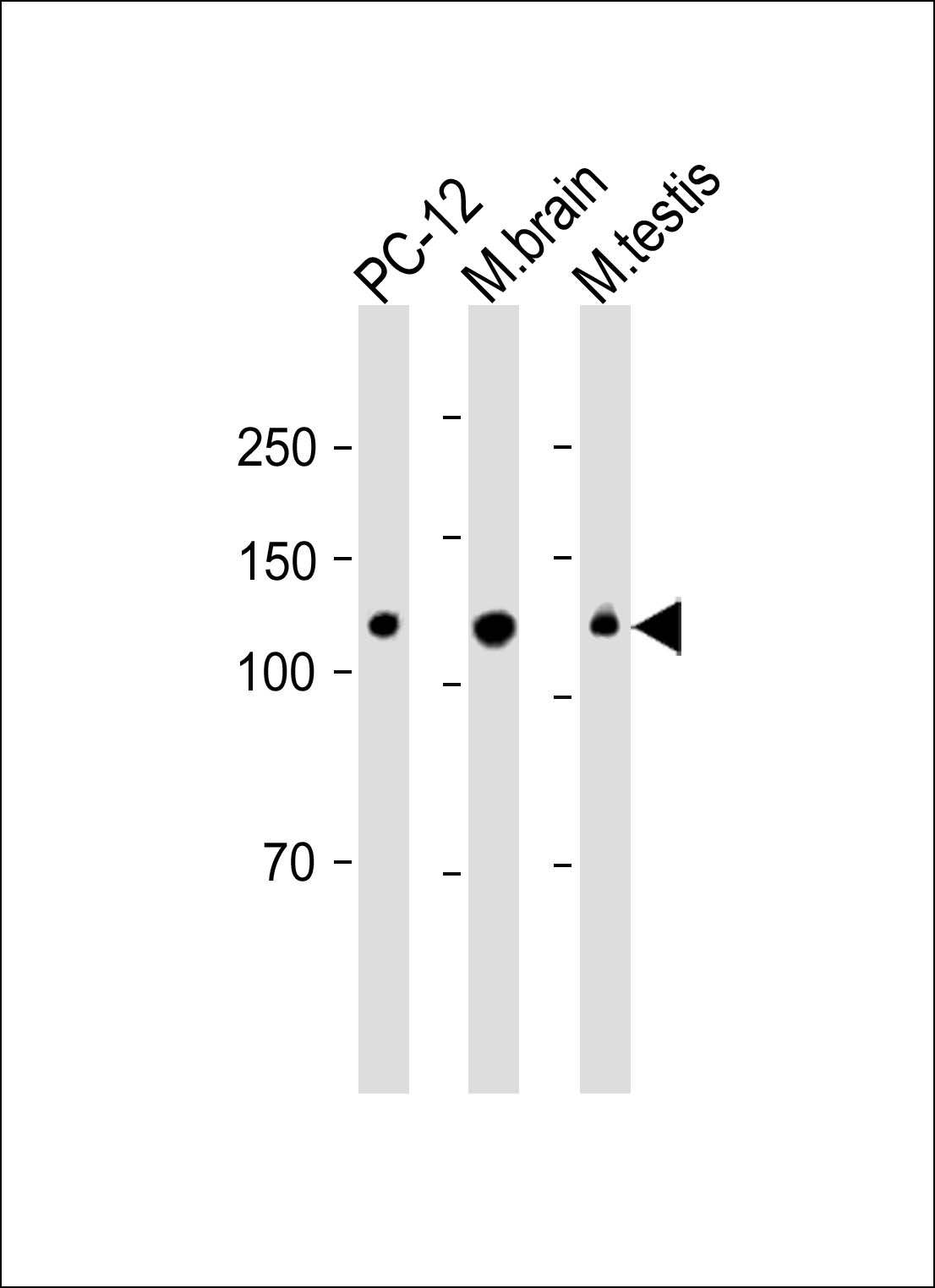 WB - Kif5C-2 Antibody AP12055a