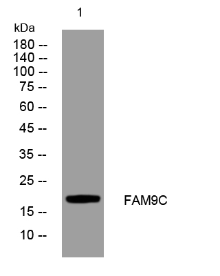WB - FAM9C Rabbit Polyclonal Antibody AP93320