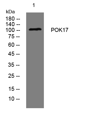 WB - POK17 Rabbit Polyclonal Antibody AP93415