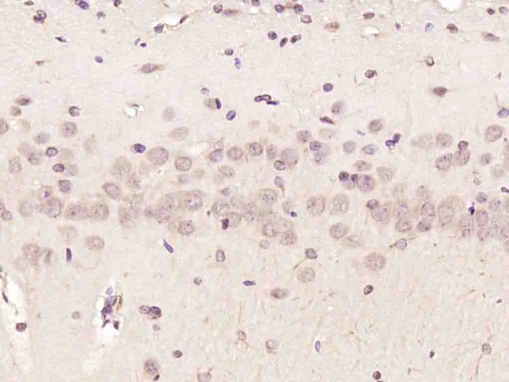 IHC-P - NUP88 Rabbit pAb AP93955