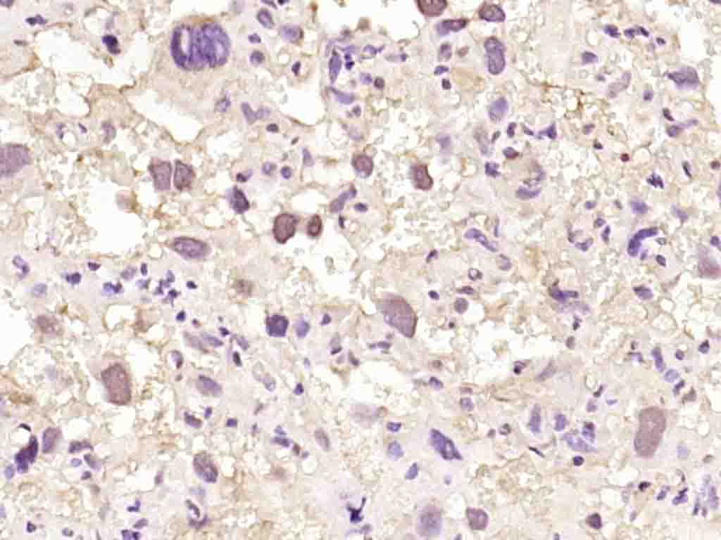 IHC-P - NUP88 Rabbit pAb AP93955