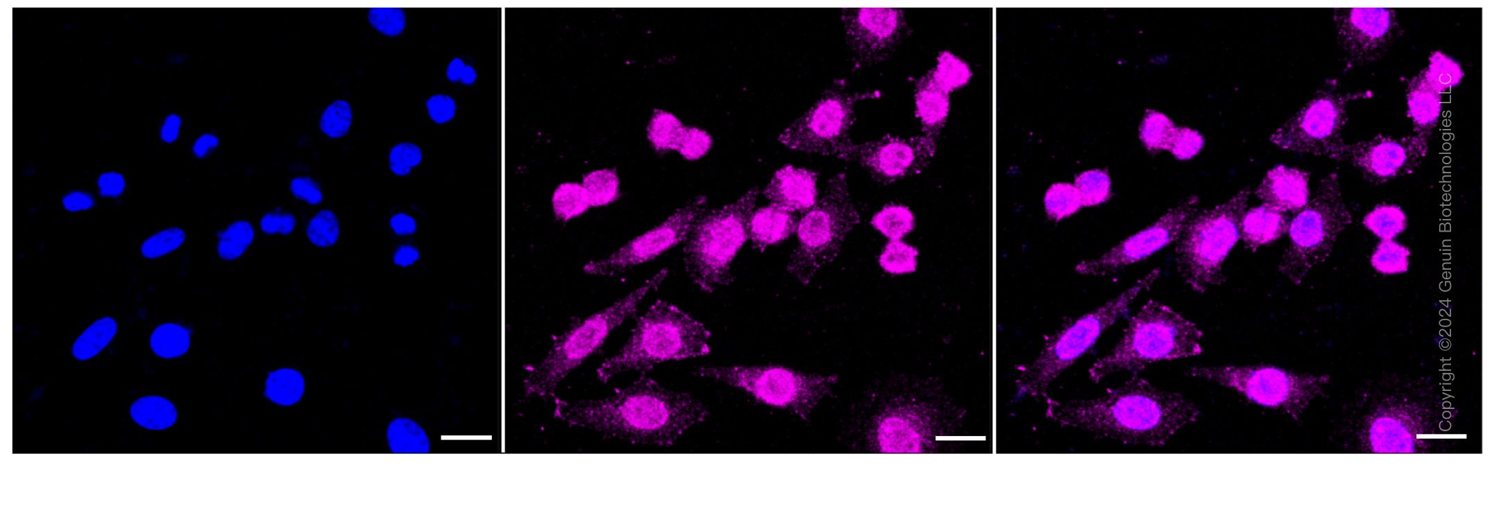 ICC - KD-Validated Anti-C4BPB Rabbit Monoclonal Antibody AGI1018